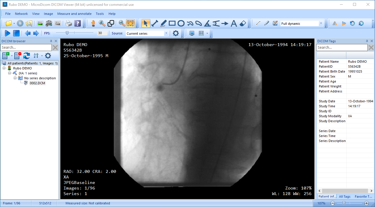 MicroDicom DICOM viewer interface