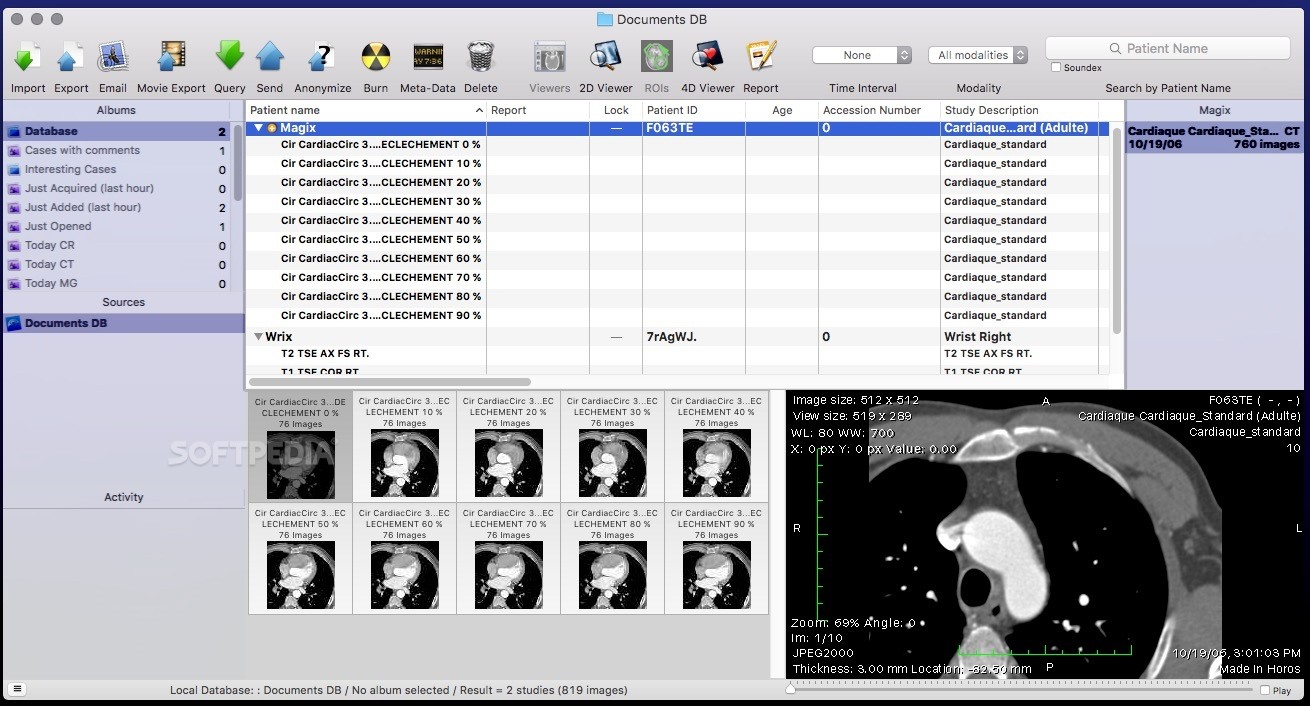 Horos free DICOM viewer interface