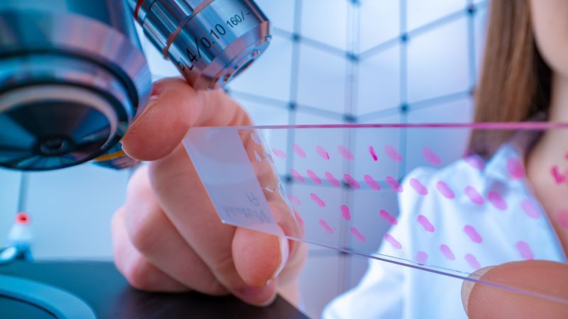 Digital pathology: five ways to ensure fast and successful adoption