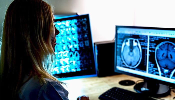radiologist looking at MRI image on computer